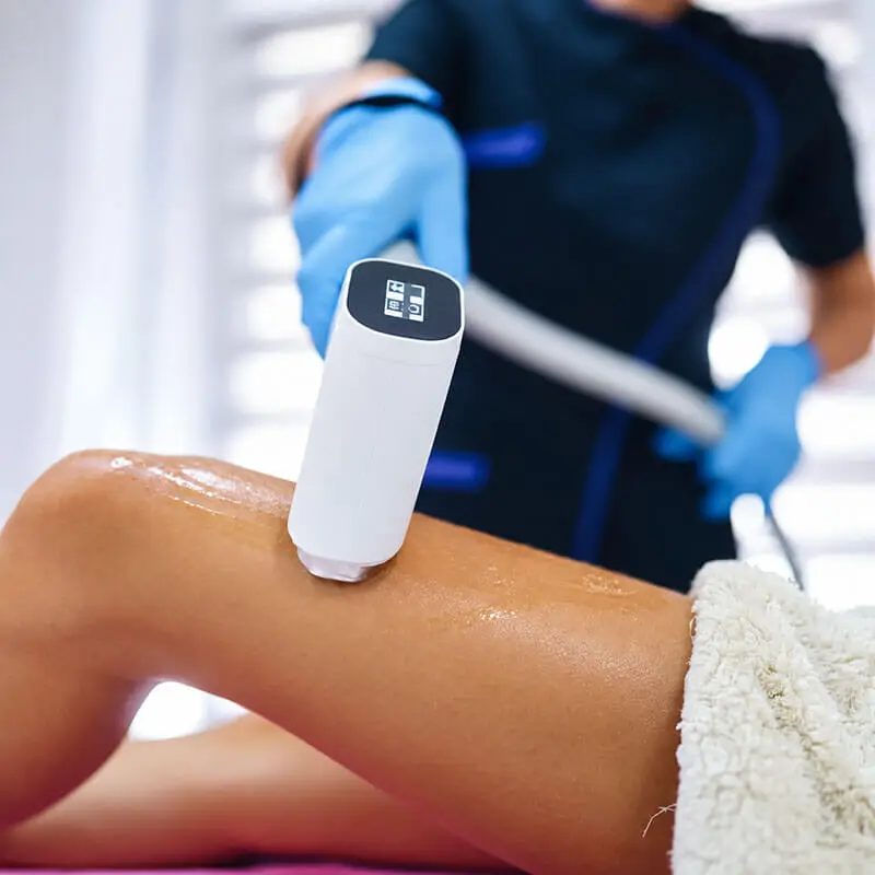 Laserska epilacija u Fizio Glišić Beauty
